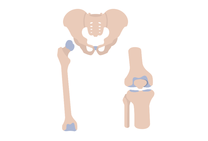 Hip and Knee Newer