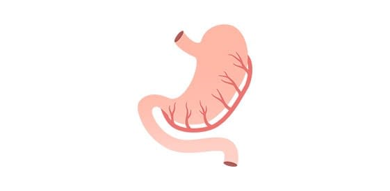_BARIATRIC