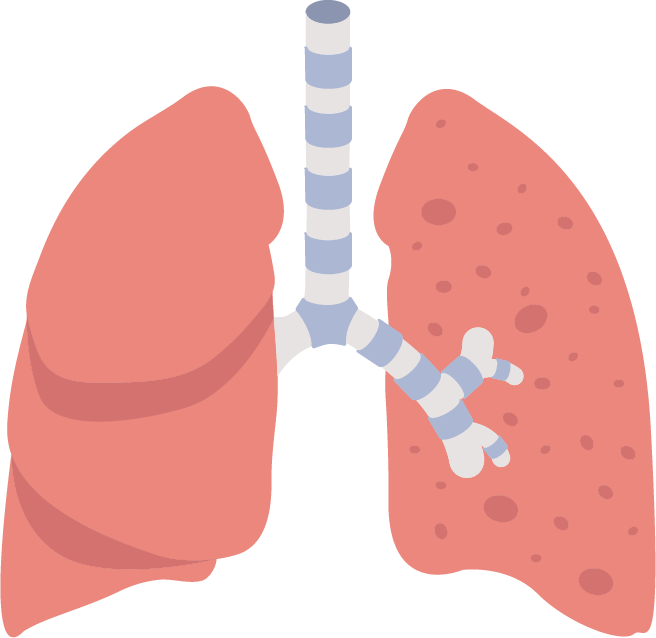 lung656x638